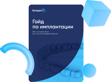 Гайд по имплантации