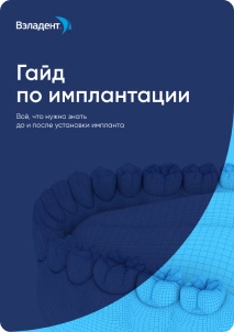 Гайд по имплантации