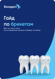 Гайд по брекетам