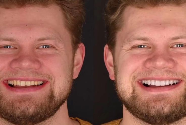 Точная цифровая копия: в Вэладент создали ИИ-аватар пациента